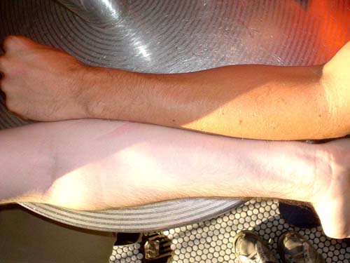 arm