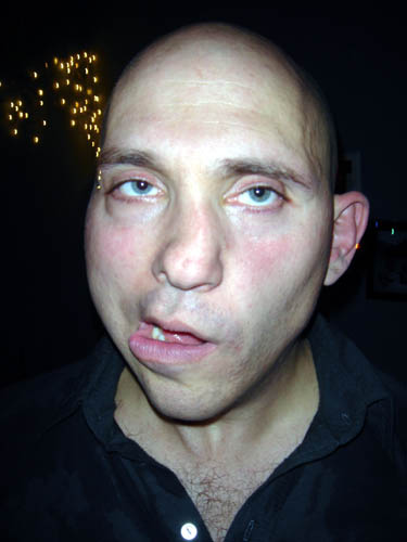 frank