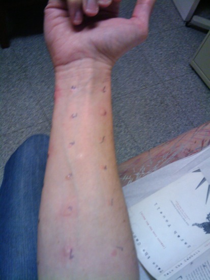 arm