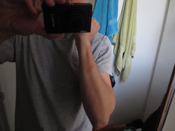 arm