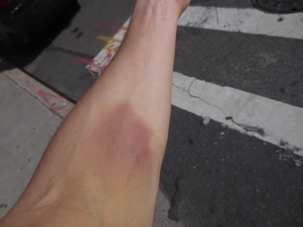 arm