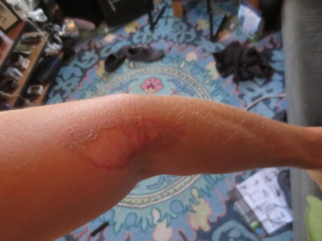 arm